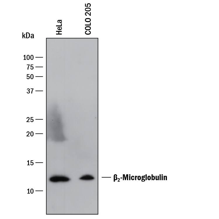 Western blot shows lysates of HeLa human cervical epithelial carcinoma cell line and COLO 205 human colorectal adenocarcinoma cell line. PVDF membrane was probed with 2 µg/mL of Mouse Anti-Human  beta 2-Microglobulin Monoclonal Antibody (Catalog # MAB8248) followed by HRP-conjugated Anti-Mouse IgG Secondary Antibody (Catalog # HAF018). A specific band was detected for  beta 2-Microglobulin at approximately 12 kDa (as indicated). This experiment was conducted under reducing conditions and using Immunoblot Buffer Group 1.