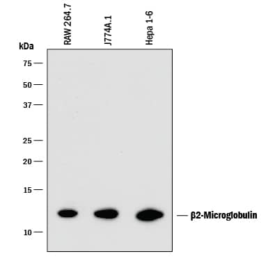 Western blot shows lysates of RAW 264.7 mouse monocyte/macrophage cell line, J774A.1 mouse reticulum cell sarcoma macrophage cell line, and Hepa 1-6 mouse hepatoma cell line. PVDF membrane was probed with 0.5 µg/mL of Rat Anti-Mouse  beta 2-Microglobulin Monoclonal Antibody (Catalog # MAB8325) followed by HRP-conjugated Anti-Rat IgG Secondary Antibody (Catalog # HAF005). A specific band was detected for  beta 2-Microglobulin at approximately 13 kDa (as indicated). This experiment was conducted under reducing conditions and using Immunoblot Buffer Group 1.