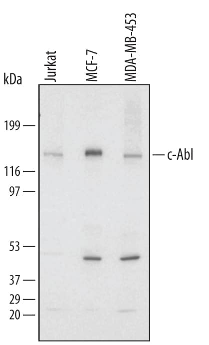 Western Blot c-Abl Antibody [Unconjugated]