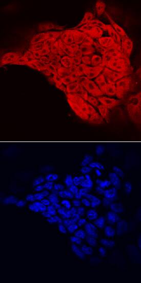 c-Myc was detected in immersion fixed D3 mouse embryonic stem cell line using Goat Anti-Human/Mouse c-Myc Antigen Affinity-purified Polyclonal Antibody (Catalog # AF3696) at 10 µg/mL for 3 hours at room temperature. Cells were stained using the NorthernLights™ 557-conjugated Anti-Goat IgG Secondary Antibody (red, upper panel; Catalog # NL001) and counterstained with DAPI (blue, lower panel). Specific staining was localized to nuclei and cytoplasm. View our protocol for Fluorescent ICC Staining of Cells on Coverslips.