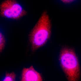 c-Fos was detected in immersion fixed HeLa human cervical epithelial carcinoma cell line using Sheep Anti-Human c-Fos Antigen Affinity-purified Polyclonal Antibody (Catalog # AF7254) at 3 µg/mL for 3 hours at room temperature. Cells were stained using the NorthernLights™ 557-conjugated Anti-Sheep IgG Secondary Antibody (red; Catalog # NL010) and counterstained with DAPI (blue). Specific staining was localized to cytoplasm and nuclei. View our protocol for Fluorescent ICC Staining of Cells on Coverslips.
