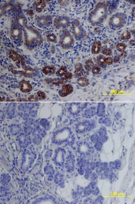 Immunohistochemistry cIAP-1/HIAP-2 Antibody [Unconjugated]