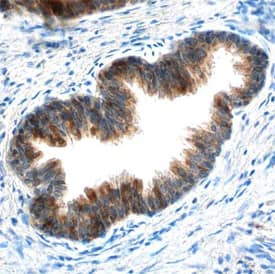 cIAP-1/HIAP-2 was detected in immersion fixed paraffin-embedded sections of human prostate using Mouse Anti-Human cIAP-1/HIAP-2 Monoclonal Antibody (Catalog # MAB8181) at 15 µg/mL overnight at 4 °C. Before incubation with the primary antibody, tissue was subjected to heat-induced epitope retrieval using Antigen Retrieval Reagent-Basic (Catalog # CTS013). Tissue was stained using the Anti-Mouse HRP-DAB Cell & Tissue Staining Kit (brown; Catalog # CTS002) and counterstained with hematoxylin (blue). Specific staining was localized to the cytoplasm of epithelial cells. View our protocol for Chromogenic IHC Staining of Paraffin-embedded Tissue Sections.