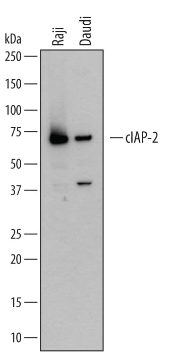 Western Blot cIAP-2/HIAP-1 Antibody [Unconjugated]