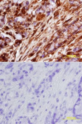 cIAP-2/HIAP-1 was detected in immersion fixed paraffin-embedded sections of human colon array using Mouse Anti-Human/Mouse cIAP-2/HIAP-1 Monoclonal Antibody (Catalog # MAB817) at 25 µg/mL overnight at 4 °C. Tissue was stained using the Anti-Mouse HRP-DAB Cell & Tissue Staining Kit (brown; Catalog # CTS002) and counterstained with hematoxylin (blue). Lower panel shows a lack of labeling if primary antibodies are omitted and tissue is stained only with secondary antibody followed by incubation with detection reagents. View our protocol for Chromogenic IHC Staining of Paraffin-embedded Tissue Sections. This application has not been tested in mouse samples.
