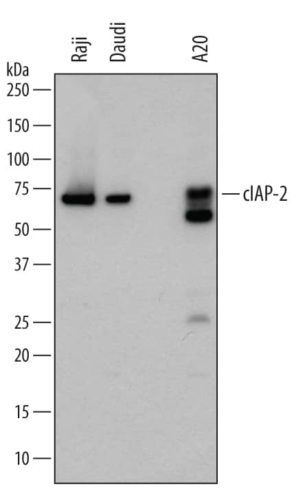 Western blot shows lysates of Raji human Burkitt's lymphoma cell line, Daudi human Burkitt's lymphoma cell line, and A20 mouse B cell lymphoma cell line. PVDF membrane was probed with 0.5 µg/mL of Mouse Anti-Human/Mouse cIAP-2/HIAP-1 Monoclonal Antibody (Catalog # MAB817) followed by HRP-conjugated Anti-Mouse IgG Secondary Antibody (Catalog # HAF007). A specific band was detected for cIAP-2/HIAP-1 at approximately 68 kDa (as indicated). This experiment was conducted under reducing conditions and using Immunoblot Buffer Group 5.