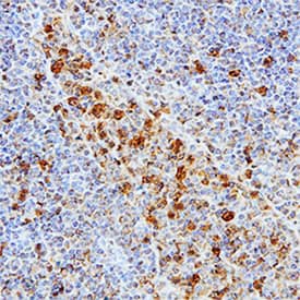 Immunohistochemistry cIAP-1/HIAP-2 Antibody [Unconjugated]