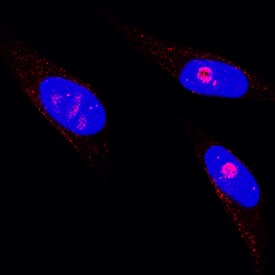 <b>Biological Strategies Validation. </b>c-Jun was detected in immersion fixed HeLa human cervical epithelial carcinoma cell line using Mouse Anti-Human/Mouse c-Jun Monoclonal Antibody (Catalog # MAB2670) at 15 µg/mL for 3 hours at room temperature. Cells were stained using the NorthernLights™ 557-conjugated Anti-Mouse IgG Secondary Antibody (red; Catalog # NL007) and counterstained with DAPI (blue). Specific staining was localized to nuclei. View our protocol for Fluorescent ICC Staining of Cells on Coverslips.