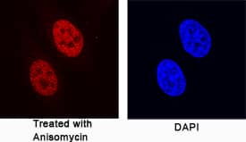 <b>Biological Strategies Validation. </b>c-Jun phosphorylated at S63 was detected in immersion fixed HeLa human cervical epithelial carcinoma cell line treated with Anisomycin using Rabbit Anti-Human Phospho-c-Jun (S63) Monoclonal Antibody (Catalog # MAB8930) at 1 µg/mL for 3 hours at room temperature. Cells were stained using the NorthernLights™ 557-conjugated Anti-Mouse IgG Secondary Antibody (red; Catalog # NL007) and counterstained with DAPI (blue). Specific staining was localized to nuclei. View our protocol for Fluorescent ICC Staining of Cells on Coverslips.