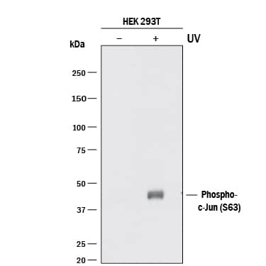 Western blot shows lysates of HEK293T human embryonic kidney cell line untreated (-) or treated (+) with 20 mJ/cm2ultraviolet light (UV) with a 30 minute recovery. PVDF membrane was probed with 0.5 µg/mL of Rabbit Anti-Human Phospho-c-Jun (S63) Monoclonal Antibody (Catalog # MAB8930) followed by HRP-conjugated Anti-Rabbit IgG Secondary Antibody (Catalog # HAF008). A specific band was detected for Phospho-c-Jun (S63) at approximately 45 kDa (as indicated). This experiment was conducted under reducing conditions and using Immunoblot Buffer Group 1.