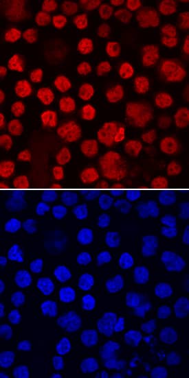 c-Maf was detected in immersion fixed RPMI 8226 human multiple myeloma cell line using Mouse Anti-Human c-Maf Monoclonal Antibody (Catalog # MAB8227) at 10 µg/mL for 3 hours at room temperature. Cells were stained using the NorthernLights™ 557-conjugated Anti-Mouse IgG Secondary Antibody (red, upper panel; Catalog # NL007) and counterstained with DAPI (blue, lower panel). Specific staining was localized to nuclei. View our protocol for Fluorescent ICC Staining of Non-adherent Cells.