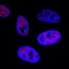 c-Myc was detected in immersion fixed HeLa human cervical epithelial carcinoma cell line using Rabbit Anti-Human c-Myc Monoclonal Antibody (Catalog # MAB36961) at 3 µg/mL for 3 hours at room temperature. Cells were stained using the NorthernLights™ 557-conjugated Anti-Rabbit IgG Secondary Antibody (red; Catalog # NL004) and counterstained with DAPI (blue). Specific staining was localized to nuclei. View our protocol for Fluorescent ICC Staining of Cells on Coverslips.