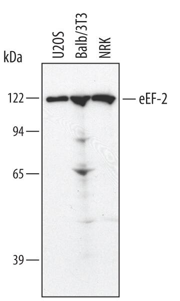 Western blot shows lysates of NRK rat normal kidney cell line, U2OS human osteosarcoma cell line, and Balb/3T3 mouse embryonic fibroblast cell line. PVDF membrane was probed with 1 µg/mL of Human/Mouse/Rat eEF-2 Antigen Affinity-purified Polyclonal Antibody (Catalog # AF3806) followed by HRP-conjugated Anti-Goat IgG Secondary Antibody (Catalog # HAF109). A specific band was detected for eEF-2 at approximately 110 kDa (as indicated). This experiment was conducted under reducing conditions and using Immunoblot Buffer Group 1.