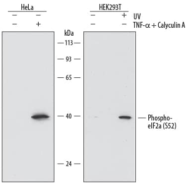 Western blot shows lysates of HeLa human cervical epithelial carcinoma cell line and HEK293T human embryonic kidney cell line untreated (-) or treated (+) with 100nM Calyculin A (Catalog # 1336) and 20 ng/mL Recombinant Human TNF-a (Catalog # 210-TA) for 10 minutes or 20 mJ/cm2 ultraviolet light (UV) followed by a 30 minute recovery. PVDF membrane was probed with 1 µg/mL of Rat Anti-Human Phospho-eIF2a (S52) Monoclonal Antibody (Catalog # MAB39971) followed by HRP-conjugated Anti-Rat IgG Secondary Antibody (Catalog # HAF005). A specific band was detected for Phospho-eIF2a (S52) at approximately 38 kDa (as indicated). This experiment was conducted under reducing conditions and using Immunoblot Buffer Group 1.