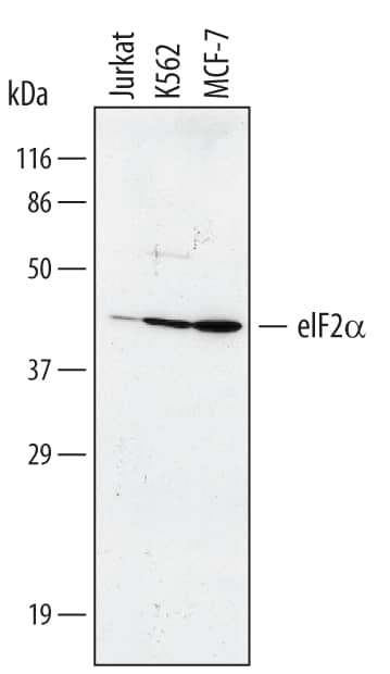Western blot shows lysates of Jurkat human acute T cell leukemia cell line, K562 human chronic myelogenous leukemia cell line, and MCF-7 human breast cancer cell line. PVDF membrane was probed with 1 µg/mL of Goat Anti-Human eIF2a Monoclonal Antibody (Catalog # MAB3997) followed by HRP-conjugated Anti-Rat IgG Secondary Antibody (Catalog # HAF005). A specific band was detected for eIF2a at approximately 40 kDa (as indicated). This experiment was conducted under reducing conditions and using Immunoblot Buffer Group 1.