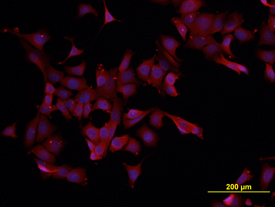 Immunocytochemistry eIF4E Antibody (299910) [Unconjugated]