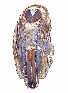 Immunohistochemistry eIF5A Antibody [Unconjugated]