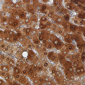 eIF5A was detected in immersion fixed paraffin-embedded sections of human liver using Sheep Anti-Human/Mouse/Rat eIF5A Antigen Affinity-purified Polyclonal Antibody (Catalog # AF7558) at 1.7 µg/mL for 1 hour at room temperature followed by incubation with the Anti-Sheep IgG VisUCyte™ HRP Polymer Antibody (Catalog # VC006). Tissue was stained using DAB (brown) and counterstained with hematoxylin (blue). Specific staining was localized to cytoplasm in hepatocytes. View our protocol for IHC Staining with VisUCyte HRP Polymer Detection Reagents.