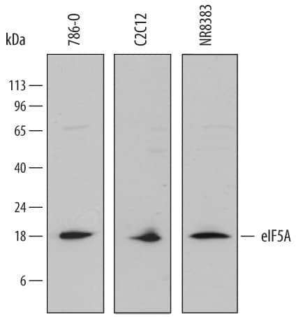 Western Blot eIF5A Antibody [Unconjugated]