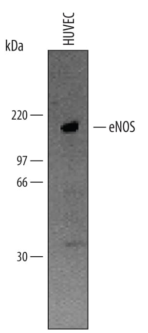 eNOS was immunoprecipitated from lysates (1 x 106cells) of HUVEC human umbilical vein endothelial cells following incubation with 0.3 µg Goat Anti-Human eNOS Antigen Affinity-purified Polyclonal Antibody (Catalog # AF950). Immunoprecipitated eNOS was detected by Western blot using 1 µg/mL Human eNOS Antigen Affinity-purified Polyclonal Antibody (Catalog # AF950). View our recommended buffer recipes for immunoprecipitation.
