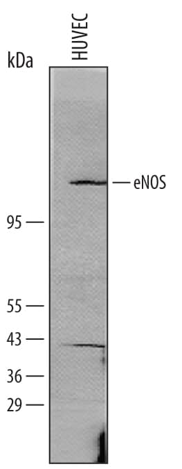 Western blot shows lysates of HUVEC human umbilical vein endothlial cells. PVDF membrane was probed with 1 µg/mL of Goat Anti-Human eNOS Affinity-purified Polyclonal Antibody (Catalog # AF950) followed by HRP-conjugated Anti-Goat IgG Secondary Antibody (Catalog # HAF109). A specific band was detected for eNOS at approximately 130-140 kDa (as indicated). This experiment was conducted under reducing conditions and using Immunoblot Buffer Group 8.