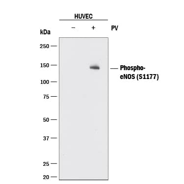 Western blot shows lysates of HUVEC human umbilical vein endothelial cells untreated (-) or treated (+) with 100 µM Pervanadate (PV) for 10 minutes. PVDF membrane was probed with 0.5 µg/mL of Rabbit Anti-Human Phospho-eNOS (S1177) Monoclonal Antibody (Catalog # MAB9028) followed by HRP-conjugated Anti-Rabbit IgG Secondary Antibody (Catalog # HAF008). A specific band was detected for eNOS at approximately 140 kDa (as indicated). This experiment was conducted under reducing conditions and using Immunoblot Buffer Group 1.