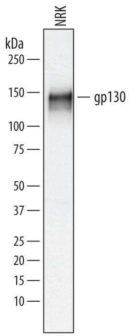 Western blot shows lysates of NRK rat normal kidney cell line. PVDF membrane was probed with 0.2 µg/mL of Sheep Anti-Rat gp130 Antigen Affinity-purified Polyclonal Antibody (Catalog # AF5029) followed by HRP-conjugated Anti-Sheep IgG Secondary Antibody (Catalog # HAF016). Specific bands were detected for gp130 at approximately 130 to 150 kDa (as indicated). This experiment was conducted under reducing conditions and using Immunoblot Buffer Group 1.