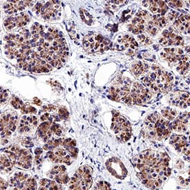 gp130 was detected in immersion fixed paraffin-embedded sections of human pancreas tissue using Mouse Anti-Human gp130 Monoclonal Antibody (Catalog # MAB628) at 5 µg/mL overnight at 4 °C. Before incubation with the primary antibody, tissue was subjected to heat-induced epitope retrieval using Antigen Retrieval Reagent-Basic (Catalog # CTS013). Tissue was stained using the Anti-Mouse IgG VisUCyte™ HRP Polymer Antibody (brown; Catalog # VC001) and counterstained with hematoxylin (blue). Specific staining was localized to cytoplasm in exocrine cells. View our protocol for IHC Staining with VisUCyte HRP Polymer Detection Reagents.