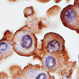 gp96/HSP90B1 was detected in immersion fixed paraffin-embedded sections of human mesothelioma tissue using Sheep Anti-Human/Mouse/Rat gp96/HSP90B1 Antigen Affinity-purified Polyclonal Antibody (Catalog # AF7606) at 1 µg/mL overnight at 4 °C. Tissue was stained using the Anti-Sheep HRP-DAB Cell & Tissue Staining Kit (brown; Catalog # CTS019) and counterstained with hematoxylin (blue). Specific staining was localized to cytoplasm and plasma membrane. View our protocol for Chromogenic IHC Staining of Paraffin-embedded Tissue Sections.