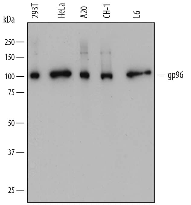 Western blot shows lysates of 293T human embryonic kidney cell line, HeLa human cervical epithelial carcinoma cell line, A20 mouse B cell lymphoma cell line, CH-1 mouse B cell lymphoma cell line, and L6 rat myoblast cell line. PVDF membrane was probed with 0.2 µg/mL of Mouse Anti-Human gp96/HSP90B1 Monoclonal Antibody (Catalog # MAB7606) followed by HRP-conjugated Anti-Mouse IgG Secondary Antibody (Catalog # HAF018). A specific band was detected for gp96/HSP90B1 at approximately 100 kDa (as indicated). This experiment was conducted under reducing conditions and using Immunoblot Buffer Group 1.
