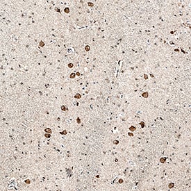 iNOS was detected in immersion fixed paraffin-embedded sections of human brain (medulla) using Mouse Anti-Human/Mouse/Rat iNOS Monoclonal Antibody (Catalog # MAB9502) at 5 µg/mL overnight at 4 °C. Tissue was stained using the Anti-Mouse HRP-DAB Cell & Tissue Staining Kit (brown; Catalog # CTS002) and counterstained with hematoxylin (blue). Specific staining was localized to neuronal cell bodies. View our protocol for Chromogenic IHC Staining of Paraffin-embedded Tissue Sections.