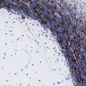 mGluR2 was detected in immersion fixed paraffin-embedded sections of human brain (cerebellum) using Mouse Anti-Human mGluR2 Monoclonal Antibody (Catalog # MAB46761) at 5 µg/mL for 1 hour at room temperature followed by incubation with the Anti-Mouse IgG VisUCyte™ HRP Polymer Antibody (Catalog # VC001). Before incubation with the primary antibody, tissue was subjected to heat-induced epitope retrieval using Antigen Retrieval Reagent-Basic (Catalog # CTS013). Tissue was stained using DAB (brown) and counterstained with hematoxylin (blue). Specific staining was localized to cell membranes in Purkinje neurons and in granular cells. View our protocol for IHC Staining with VisUCyte HRP Polymer Detection Reagents.