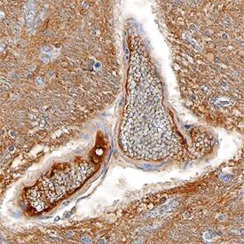mGluR4 was detected in immersion fixed paraffin-embedded sections of human brainstem (medulla) using Sheep Anti-Human mGluR4 Antigen Affinity-purified Polyclonal Antibody (Catalog # AF7387) at 1.7 µg/mL overnight at 4 °C. Tissue was stained using the Anti-Sheep HRP-DAB Cell & Tissue Staining Kit (brown; Catalog # CTS019) and counterstained with hematoxylin (blue). Specific staining was localized to endothelial cells in vasculature. View our protocol for Chromogenic IHC Staining of Paraffin-embedded Tissue Sections.