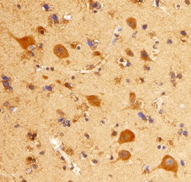 Immunohistochemistry mGluR8 Antibody (476410)