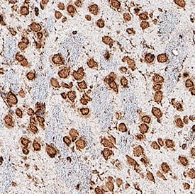 Immunohistochemistry Frizzled-3 Antibody (169310) [Unconjugated]