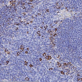 Ig Lambda Light Chain was detected in immersion fixed paraffin-embedded sections of human tonsil using Mouse Anti-Human Ig Lambda Light Chain Monoclonal Antibody (Catalog # MAB10049) at 5 µg/ml for 1 hour at room temperature followed by incubation with the Anti-Mouse IgG VisUCyte&trade; HRP Polymer Antibody (Catalog # VC001). Before incubation with the primary antibody, tissue was subjected to heat-induced epitope retrieval using VisUCyte Antigen Retrieval Reagent-Basic (Catalog # VCTS021). Tissue was stained using DAB (brown) and counterstained with hematoxylin (blue). Specific staining was localized to the cytoplasm. View our protocol for IHC Staining with VisUCyte HRP Polymer Detection Reagents.