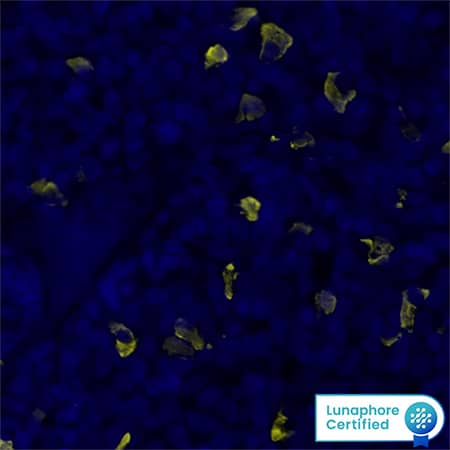 IgLambda was detected in immersion fixed paraffin-embedded sections of human Tonsil using Mouse Anti-Human IgLambda, Monoclonal Antibody (Catalog # MAB10049) at 0.5ug/mL at 37 ° Celsius for 4 minutes. Before incubation with the primary antibody, tissue underwent an all-in-one dewaxing and antigen retrieval preprocessing using PreTreatment Module (PT Module) and Dewax and HIER Buffer H (pH 9; Epredia Catalog # TA-999-DHBH). Tissue was stained using the Alexa Fluor™ 555 Goat anti-Mouse IgG Secondary Antibody at 1:100 at 37 ° Celsius for 2 minutes. (Yellow; Lunaphore Catalog # DR555MS) and counterstained with DAPI (blue; Lunaphore Catalog # DR100). Specific staining was localized to the cytoplasm. Protocol available in COMET™ Panel Builder.
