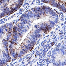 CD44 was detected in immersion fixed paraffin-embedded sections of Human Colon using Mouse Anti-Human CD44 Monoclonal Antibody (Catalog # MAB10146) at 5 µg/mL for 1 hour at room temperature followed by incubation with the Anti-Mouse IgG VisUCyte™ HRP Polymer Antibody (Catalog # VC001). Before incubation with the primary antibody, tissue was subjected to heat-induced epitope retrieval using VisUCyte Antigen Retrieval Reagent-Basic (Catalog # VCTS021). Tissue was stained using DAB (brown) and counterstained with hematoxylin (blue). Specific staining was localized to plasma membrane in glandular epithelial cells . View our protocol for IHC Staining with VisUCyte HRP Polymer Detection Reagents.