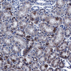 Immunohistochemistry CD200R1L Antibody (2692A) [Unconjugated]