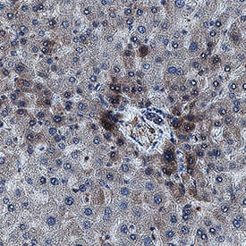Immunohistochemistry ITIH2 Antibody (2688A) [Unconjugated]