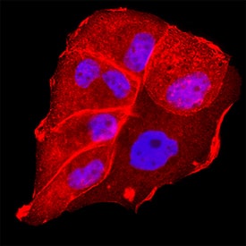 GPR158 was detected in immersion fixed T47D human breast cancer cell line using Mouse Anti-Human GPR158 Monoclonal Antibody (Catalog # MAB102861) at 8 µg/mL for 3 hours at room temperature. Cells were stained using the NorthernLights™ 557-conjugated Anti-Mouse IgG Secondary Antibody (red; NL007) and counterstained with DAPI (blue). Specific staining was localized to cell membrane. Staining was performed using our protocol for Fluorescent ICC Staining of Non-adherent Cells.