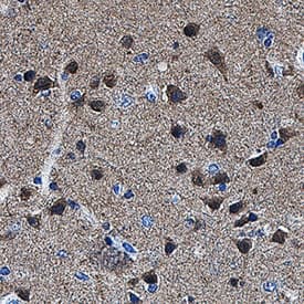 GPR158 was detected in immersion fixed paraffin-embedded sections of human brain (cortex) tissue using Mouse Anti-Human GPR158 Monoclonal Antibody (Catalog # MAB10286) at 5 µg/mL for 1 hour at room temperature followed by incubation with the Anti-Mouse IgG VisUCyte™ HRP Polymer Antibody (VC001). Before incubation with the primary antibody, tissue was subjected to heat-induced epitope retrieval using Antigen Retrieval Reagent-Basic (CTS013). Tissue was stained using DAB (brown) and counterstained with hematoxylin (blue). Specific staining was localized to cytoplasm in neurons. Staining was performed using our protocol for IHC Staining with VisUCyte HRP Polymer Detection Reagents.