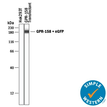 Simple Western lane view shows lysates of HEK293T human embryonic kidney cell line either mock transfected or transfected with GPR-158 and eGFP, loaded at 0.2 mg/mL. A specific band was detected for GPR158 at approximately 191 kDa (as indicated) using 25 µg/mL of Mouse Anti-Human GPR158 Monoclonal Antibody (Catalog # MAB10286) . This experiment was conducted under reducing conditions and using the 12-230 kDa separation system.