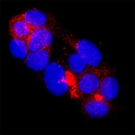 CA19-9 was detected in immersion fixed Capan‑2 human pancreatic adenocarcinoma cell line using Mouse Anti-Human CA19-9 Monoclonal Antibody (Catalog # MAB10625) at 8 µg/mL for 3 hours at room temperature. Cells were stained using the NorthernLights™ 557-conjugated Anti-Mouse IgG Secondary Antibody (red; NL007) and counterstained with DAPI (blue). Specific staining was localized to cytoplasm. Staining was performed using our protocol for Fluorescent ICC Staining of Non-adherent Cells.