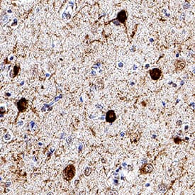 Tau was detected in immersion fixed paraffin-embedded sections of human brain (Alzheimer's) using Mouse Anti-Human Tau Monoclonal Antibody (Catalog # MAB106291) at 5 µg/mL for 1 hour at room temperature followed by incubation with the Anti-Mouse IgG VisUCyte™ HRP Polymer Antibody (VC001). Before incubation with the primary antibody, tissue was subjected to heat-induced epitope retrieval using Antigen Retrieval Reagent-Basic (CTS013). Tissue was stained using DAB (brown) and counterstained with hematoxylin (blue). Specific staining was localized to cytoplasm in neurons and neuronal processes. Staining was performed using our protocol for IHC Staining with VisUCyte HRP Polymer Detection Reagents.