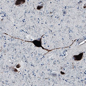 Tau was detected in immersion fixed paraffin-embedded sections of human brain (Alzheimer's) using Mouse Anti-Human Tau Monoclonal Antibody (Catalog # MAB10629) at 5 µg/mL for 1 hour at room temperature followed by incubation with the Anti-Mouse IgG VisUCyte™ HRP Polymer Antibody (VC001). Before incubation with the primary antibody, tissue was subjected to heat-induced epitope retrieval using Antigen Retrieval Reagent-Basic (CTS013). Tissue was stained using DAB (brown) and counterstained with hematoxylin (blue). Specific staining was localized to neurons. Staining was performed using our protocol for IHC Staining with VisUCyte HRP Polymer Detection Reagents.
