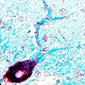 <b>Orthogonal Strategies Validation. </b>NEFL mRNA (red) and protein (green/blue) was detected in formalin-fixed paraffin-embedded tissue sections of Human Cerebellum. ACD’s Integrated Co-Detection Workflow was performed using ACD RNAScope Probe Hs-NEFL (Catalog# 468671) and Mouse Anti-Human NEFL monoclonal antibody (R&D Systems, Catalog# MAB10680) at 10 ug/mL. Tissue was stained using RNAscope® 2.5 HD Detection Reagents-RED (Catalog# 322360), Mouse IgG VisUCyte HRP Polymer Antibody (VC001), and RNAscope® 2.5 LS Green Accessory Pack (Catalog# 322550). Tissue was counterstained with 50% hematoxylin (purple).