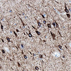 NF‑L was detected in immersion fixed paraffin-embedded sections of human brain (hippocampus) using Mouse Anti-Human NF‑L Monoclonal Antibody (Catalog # MAB10680) at 15 µg/mL for 1 hour at room temperature followed by incubation with the Anti-Mouse IgG VisUCyte™ HRP Polymer Antibody (VC001). Before incubation with the primary antibody, tissue was subjected to heat-induced epitope retrieval using Antigen Retrieval Reagent-Basic (CTS013). Tissue was stained using DAB (brown) and counterstained with hematoxylin (blue). Specific staining was localized to cytoplasm in neurons. Staining was performed using our protocol for IHC Staining with VisUCyte HRP Polymer Detection Reagents.