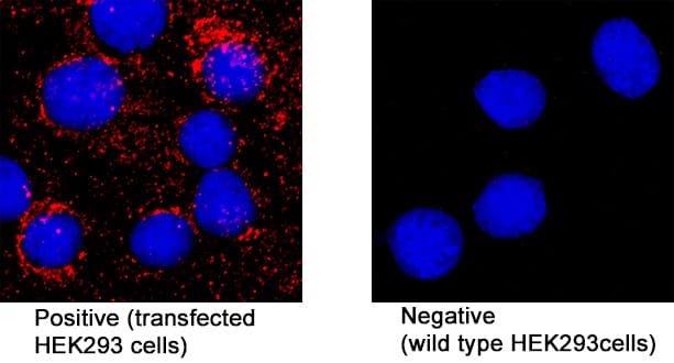 SARS-CoV-2 Membrane Protein was detected in immersion fixed HEK293 human embryonic kidney cell line transfected with SARS-CoV-2 (positive staining) and HEK293 human embryonic kidney cell line (non-transfected, negative staining) using Mouse Anti-SARS-CoV-2 Membrane Monoclonal Antibody (Catalog # MAB10690) at 8 µg/mL for 3 hours at room temperature. Cells were stained using the NorthernLights™ 557-conjugated Anti-Mouse IgG Secondary Antibody (red; NL007) and counterstained with DAPI (blue). Specific staining was localized to cytoplasm. Staining was performed using our protocol for Fluorescent ICC Staining of Non-adherent Cells.