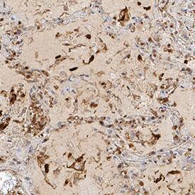 ORF3a was detected in immersion fixed paraffin-embedded sections of human spleen infected with SARS-CoV-2 using Rabbit Anti-SARS-CoV-2 ORF3a Monoclonal Antibody (Catalog # MAB107061) at 0.3 &micro;g/mL for 1 hour at room temperature followed by incubation with the Anti-Rabbit IgG VisUCyte&trade; HRP Polymer Antibody (VC003). Before incubation with the primary antibody, tissue was subjected to heat-induced epitope retrieval using Antigen Retrieval Reagent-Basic (CTS013). Tissue was stained using DAB (brown) and counterstained with hematoxylin (blue). Specific staining was localized to immunoreactive profiles scattered throughout the tissue. Staining was performed using our protocol for IHC Staining with VisUCyte HRP Polymer Detection Reagents.